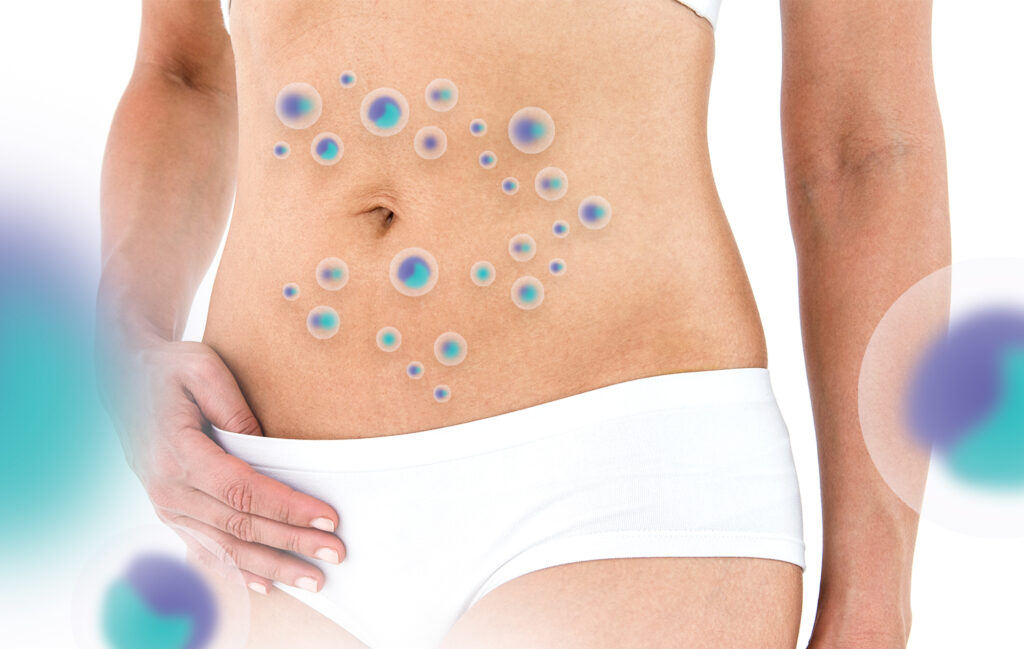 Darm Health Check