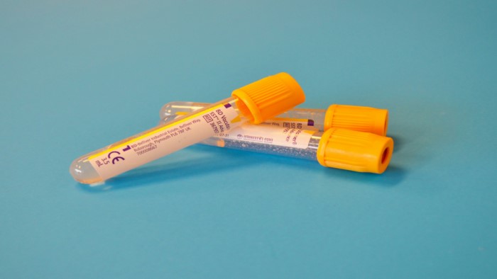 Cholesterol onderzoek